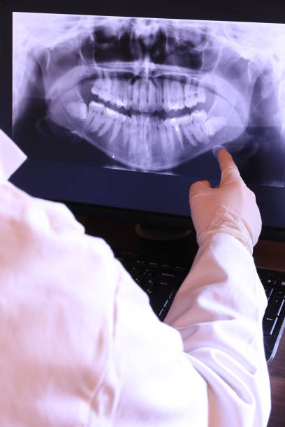 Best Emergency Tooth Extraction in Somerset, NJ