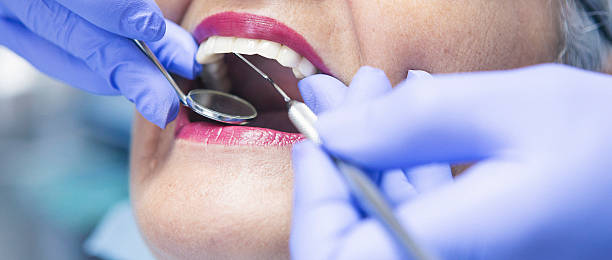 Best Emergency Gum Treatment in Somerset, NJ